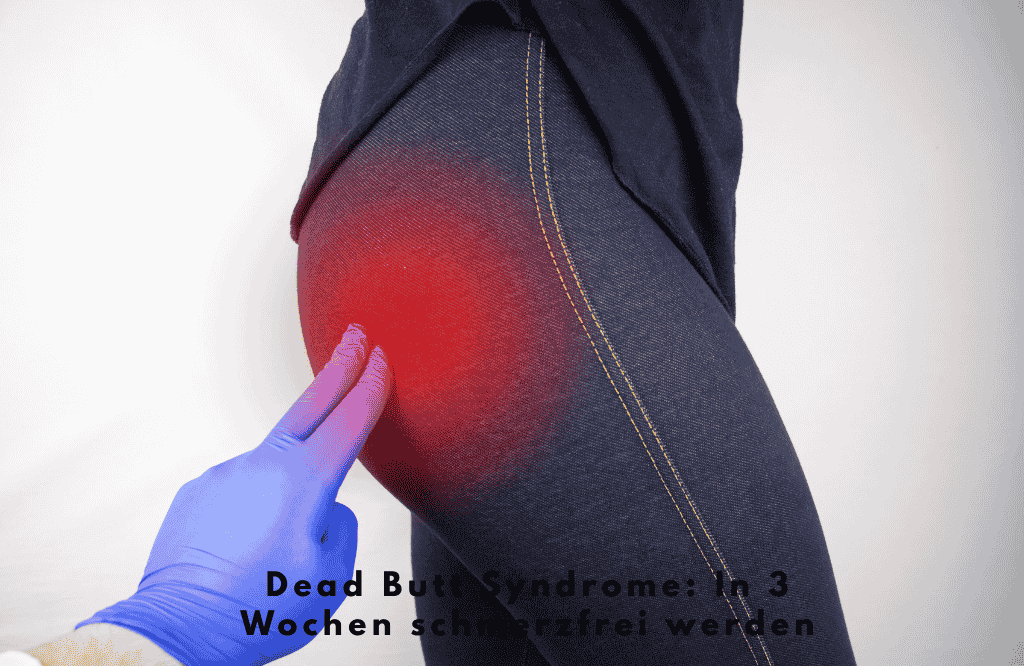 Dead Butt Syndrome: In 3 Wochen schmerzfrei werden